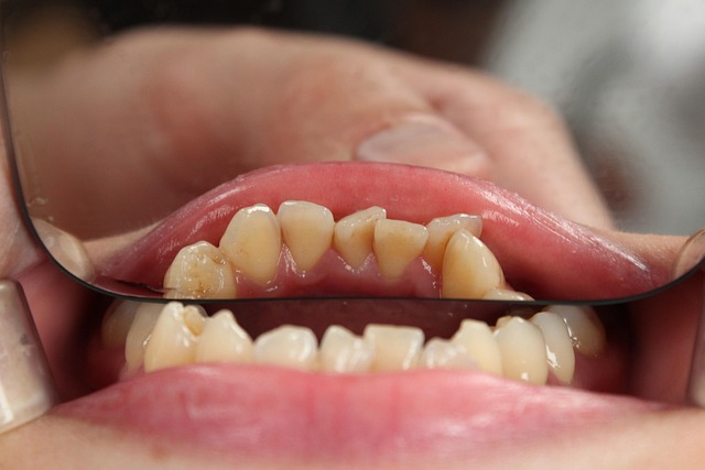Harlingen Dental: Enhance Your Smile with Advanced Cosmetic Procedures